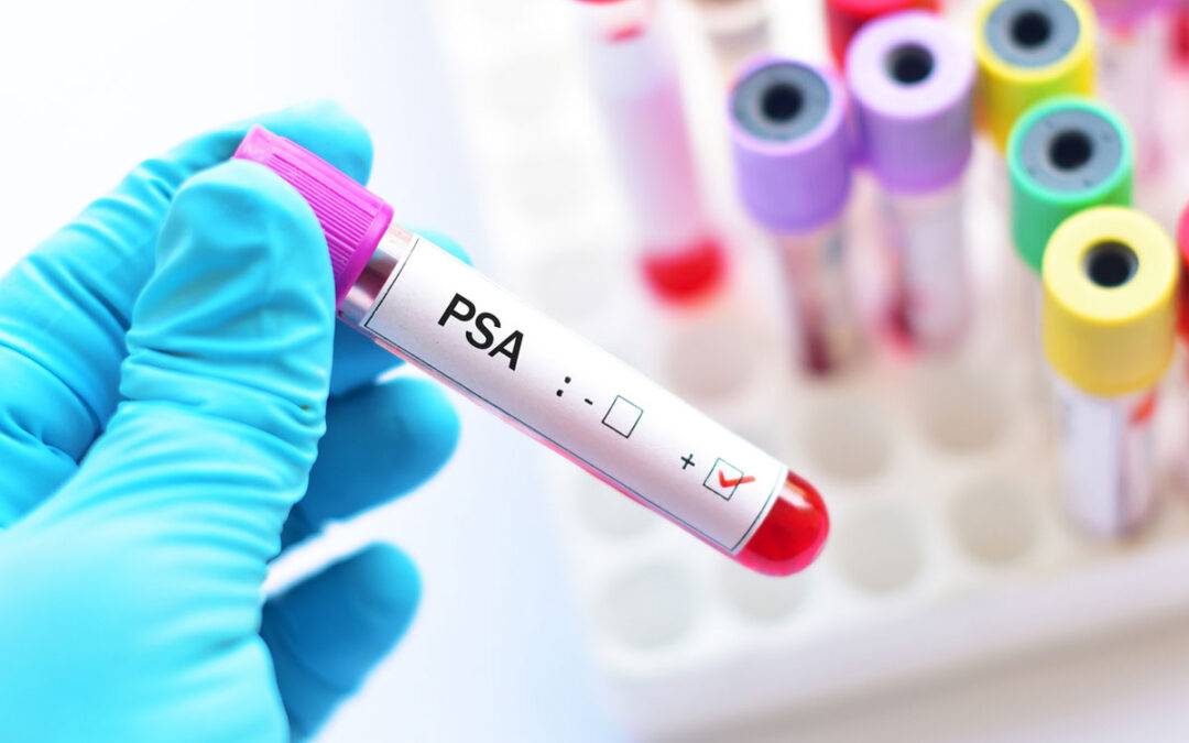 PSA élevé et risque de cancer prostate ?