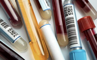 Quel taux de PSA pour une hypertrophie de la prostate ?